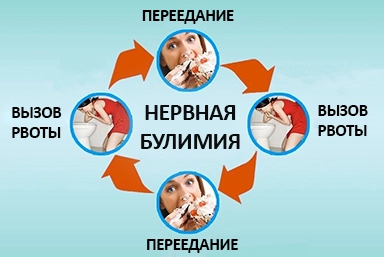 Лечение булимии в Бачатском